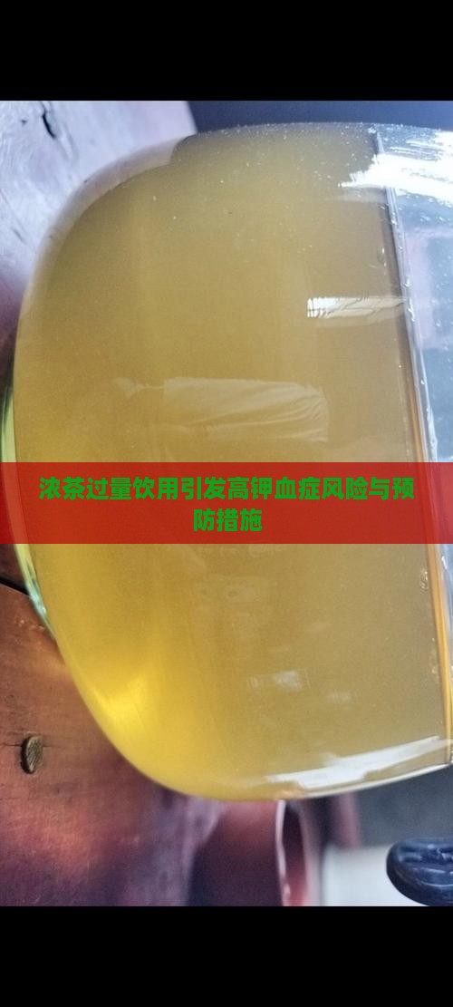 浓茶过量饮用引发高钾血症风险与预防措施