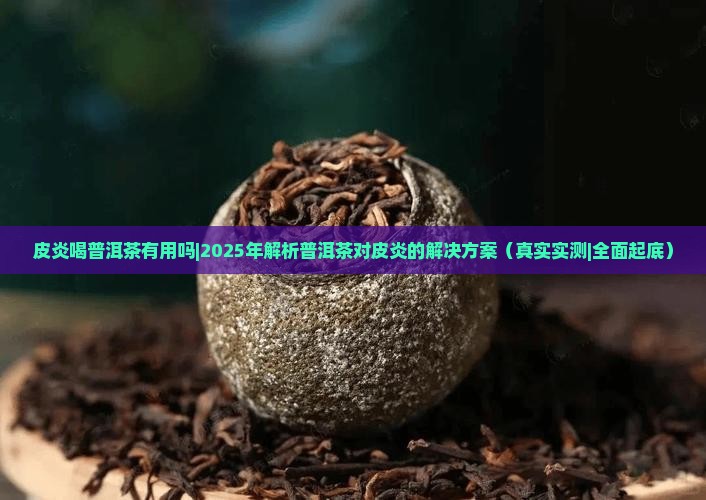 皮炎喝普洱茶有用吗