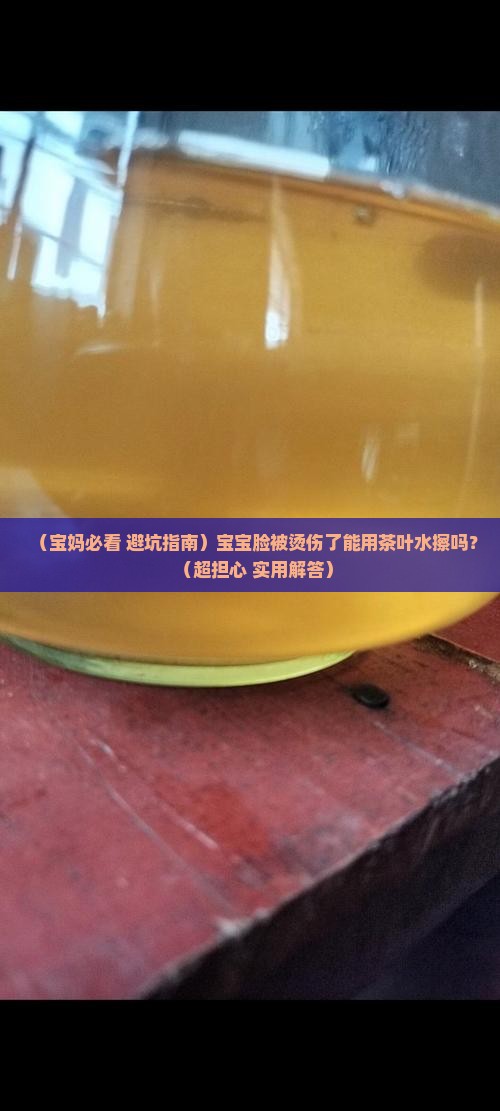 宝宝脸烫伤后能用茶叶水擦脸吗
