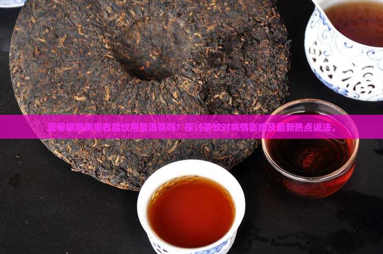 夏季银屑病患者能饮用普洱茶吗？探讨茶饮对病情影响及最新热点说法。
