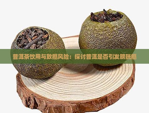 普洱茶饮用与致癌风险：探讨普洱是否引发膀胱癌