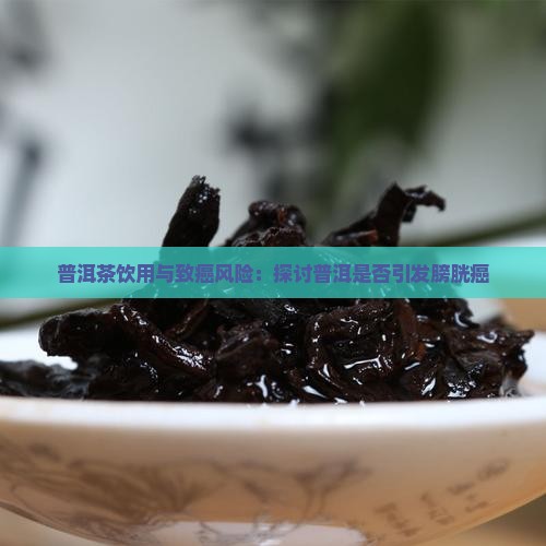 普洱茶饮用与致癌风险：探讨普洱是否引发膀胱癌