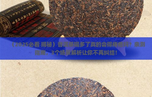 普洱茶喝多会痔疮吗