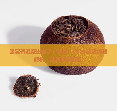 喝完普洱茶有出血怎么回事