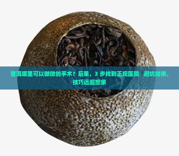普洱哪里可以做微创手术