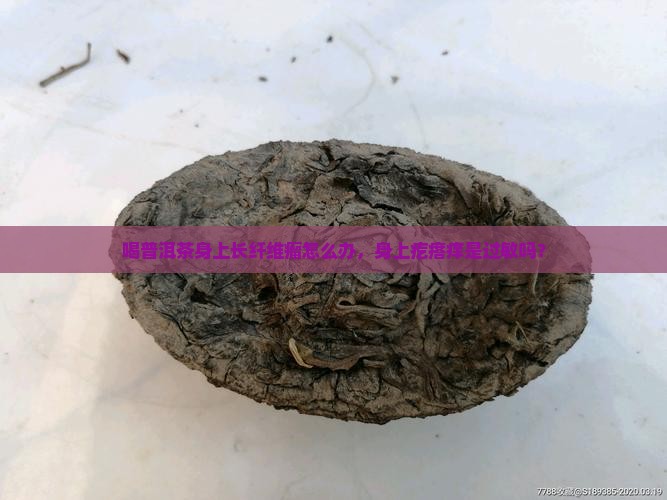 喝普洱茶身上长纤维瘤怎么办，身上疙瘩痒是过敏吗？