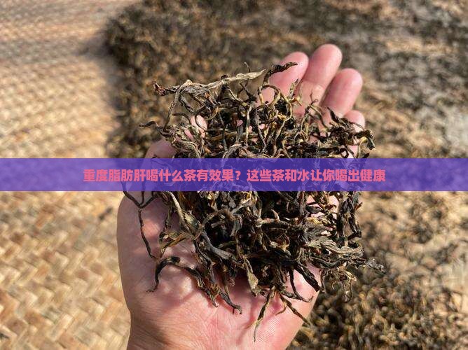 重度脂肪肝喝什么茶有效果？这些茶和水让你喝出健康