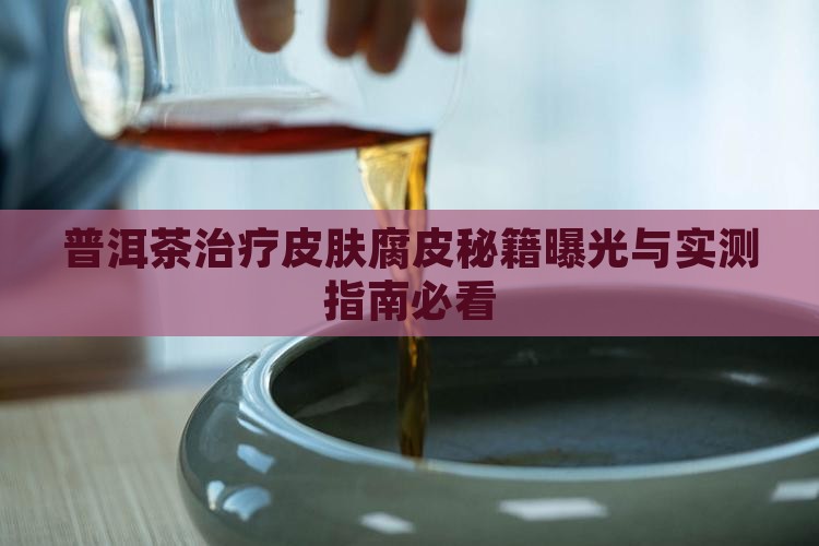 普洱茶可以治腐皮吗百度