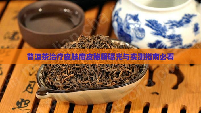 普洱茶可以治腐皮吗百度