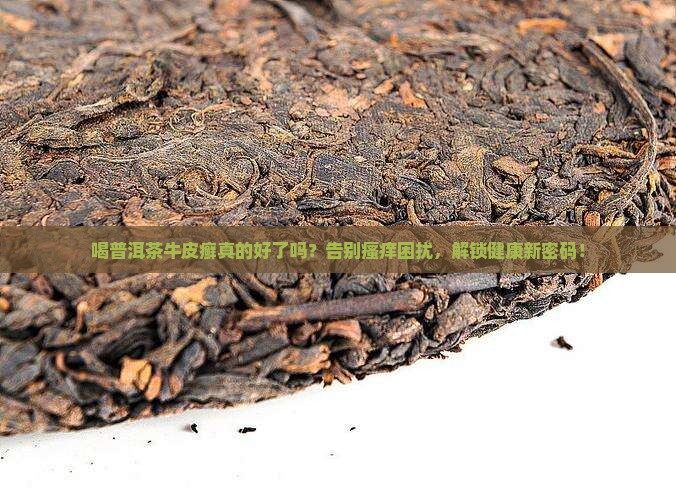 喝普洱茶牛皮癣好了