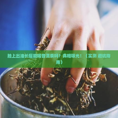 脸上出油长痘能喝普洱茶吗