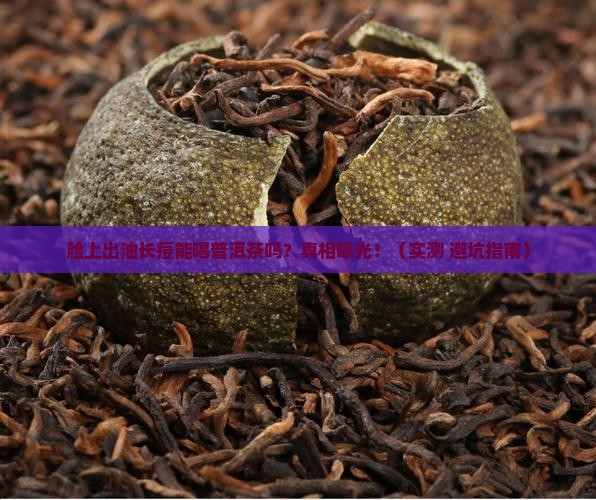 脸上出油长痘能喝普洱茶吗