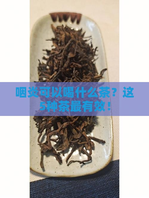 咽炎可以喝什么茶
