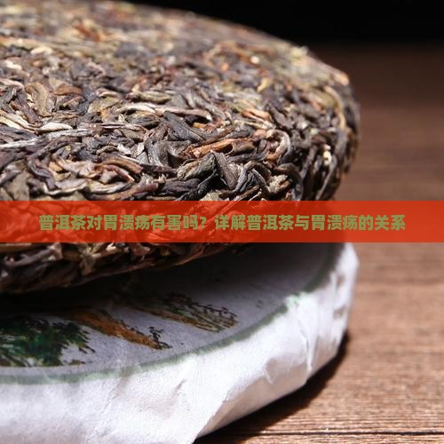 普洱茶对胃溃疡有害吗