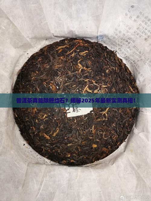 普洱茶除胆结石