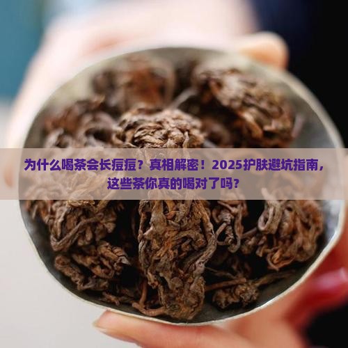 为什么喝茶会长痘痘