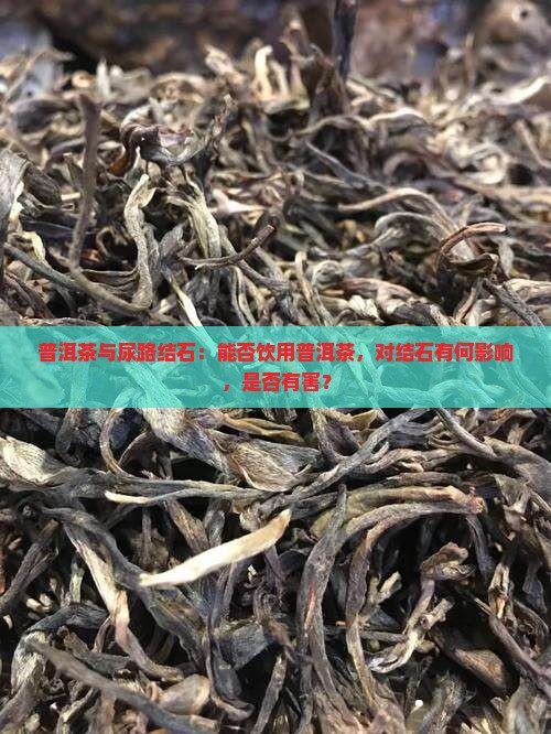 普洱茶与尿路结石