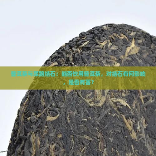 普洱茶与尿路结石