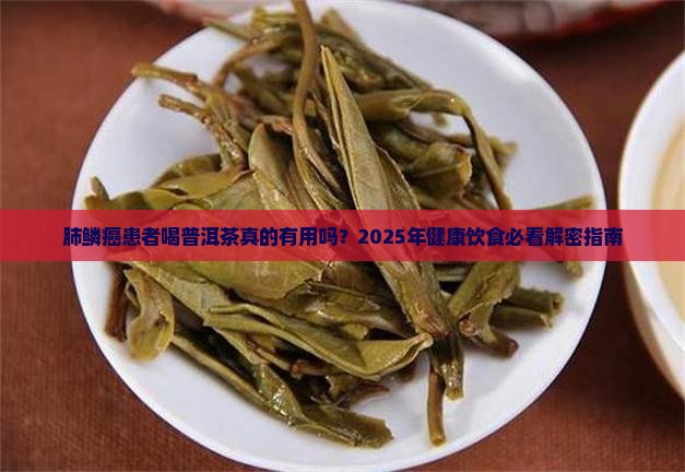 肺鳞癌喝普洱茶