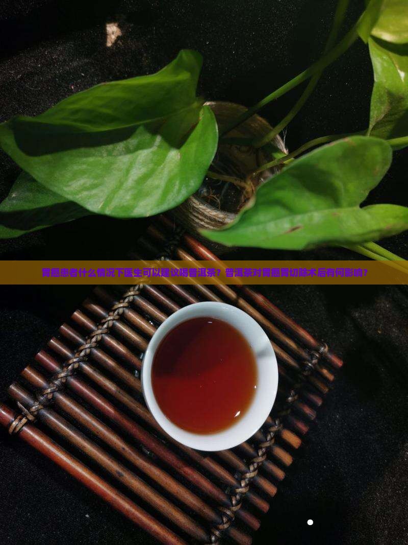 胃癌胃切除能喝普洱茶吗