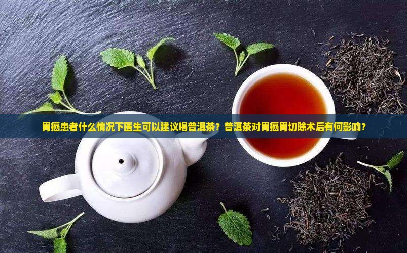 胃癌胃切除能喝普洱茶吗