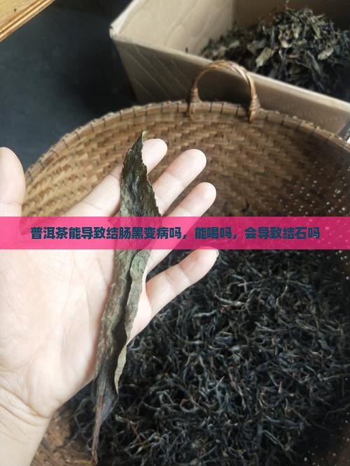 普洱茶能导致结肠黑变病吗