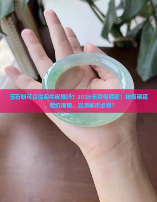 玉石粉可以治愈牛皮癣不