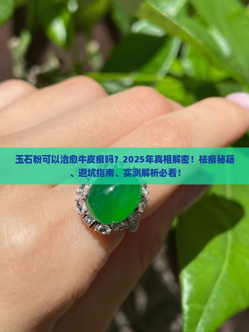 玉石粉可以治愈牛皮癣不