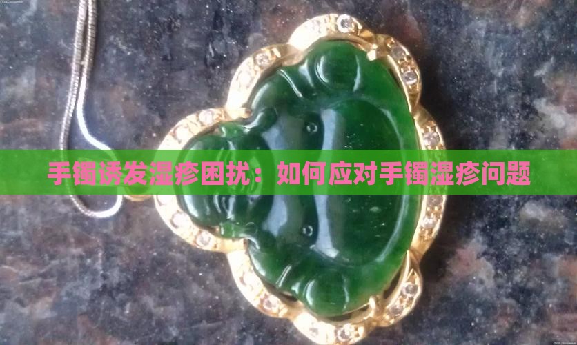 手镯诱发湿疹困扰：如何应对手镯湿疹问题