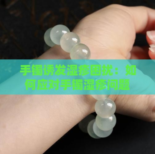 手镯诱发湿疹困扰：如何应对手镯湿疹问题