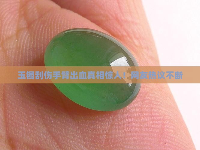 玉镯刮伤手臂出血