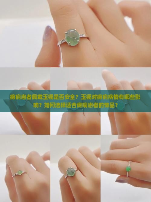 癫痫患者佩戴玉镯是否安全？玉镯对癫痫病情有哪些影响？如何选择适合癫痫患者的饰品？