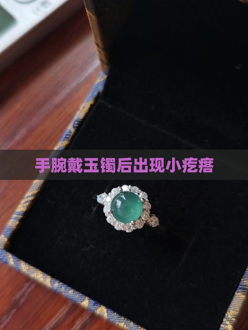手腕戴玉镯后出现小疙瘩