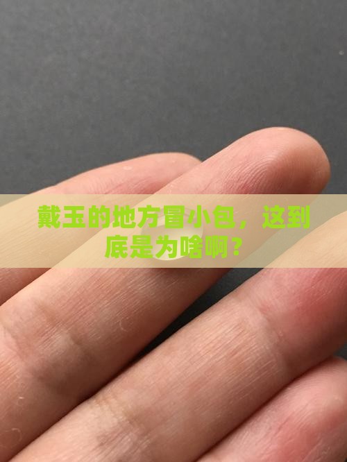为什么带玉石的部位起疙瘩