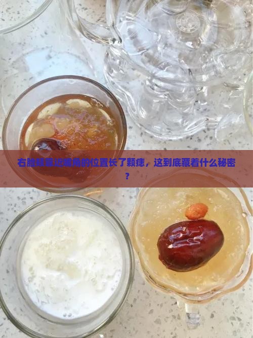 右燕窝旁边有痣代表什么