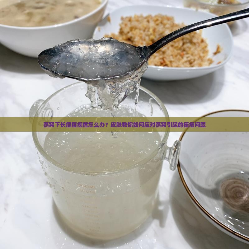 燕窝下长痘痘疙瘩怎么办？皮肤教你如何应对燕窝引起的痤疮问题
