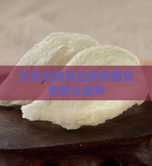 艾灸后皮肤出现痒感究竟怎么回事