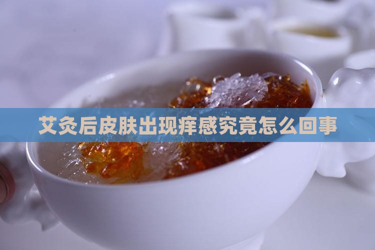 艾灸后皮肤出现痒感究竟怎么回事