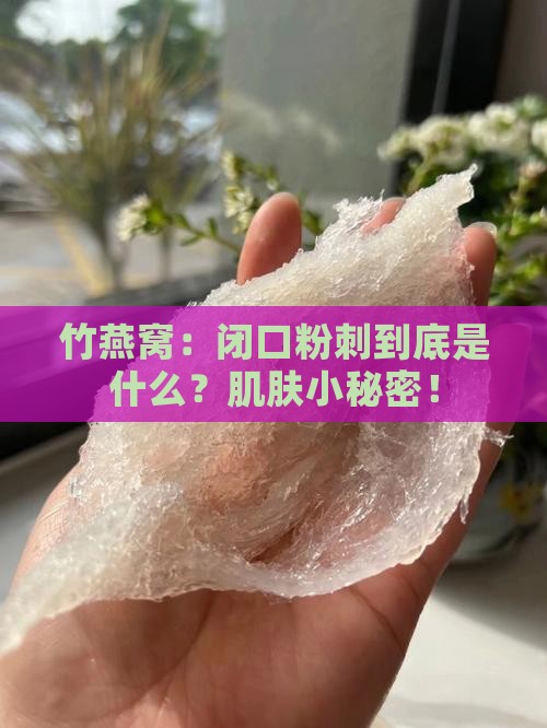 竹燕窝：闭口粉刺到底是什么？肌肤小秘密！