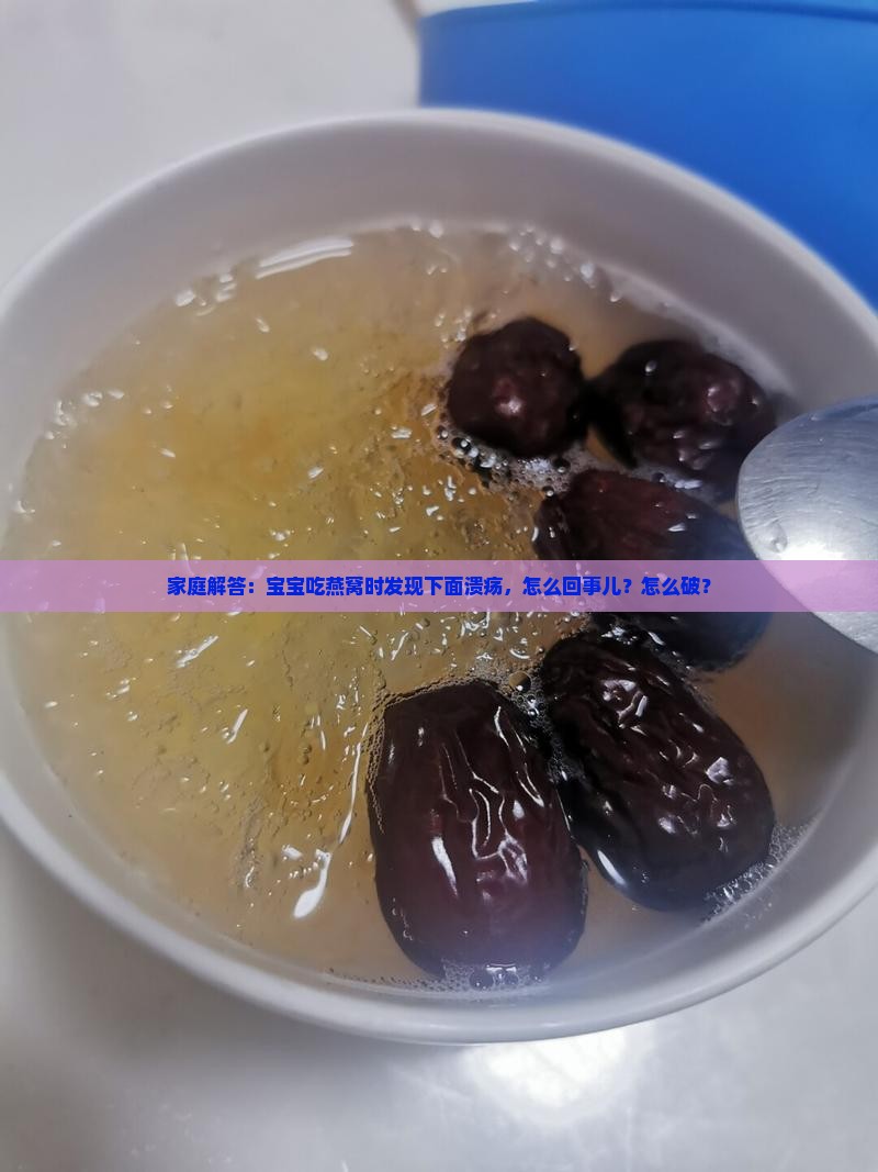 家庭解答：宝宝吃燕窝时发现下面溃疡，怎么回事儿？怎么破？