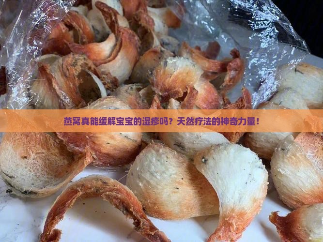 燕窝真能缓解宝宝的湿疹吗？天然疗法的神奇力量！