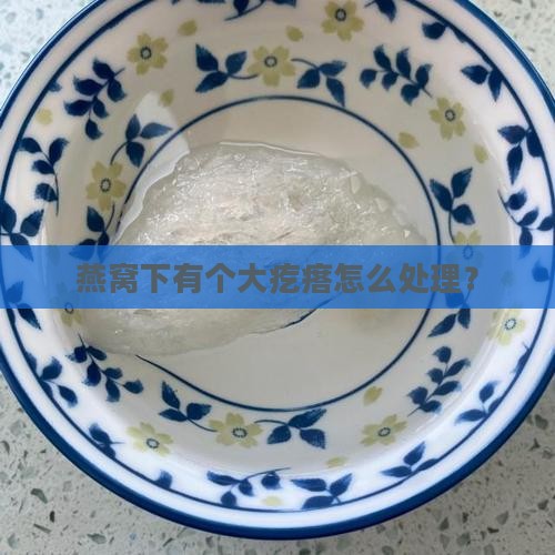 燕窝下有个大疙瘩怎么办