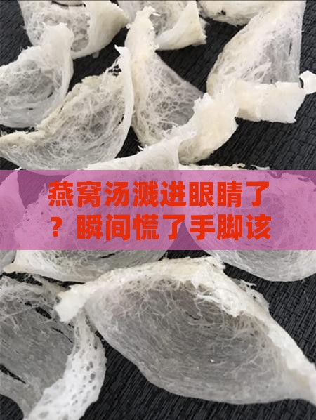 燕窝的水进眼睛了怎么办