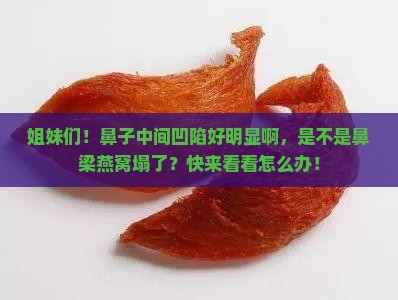 鼻梁燕窝凹陷怎么回事啊