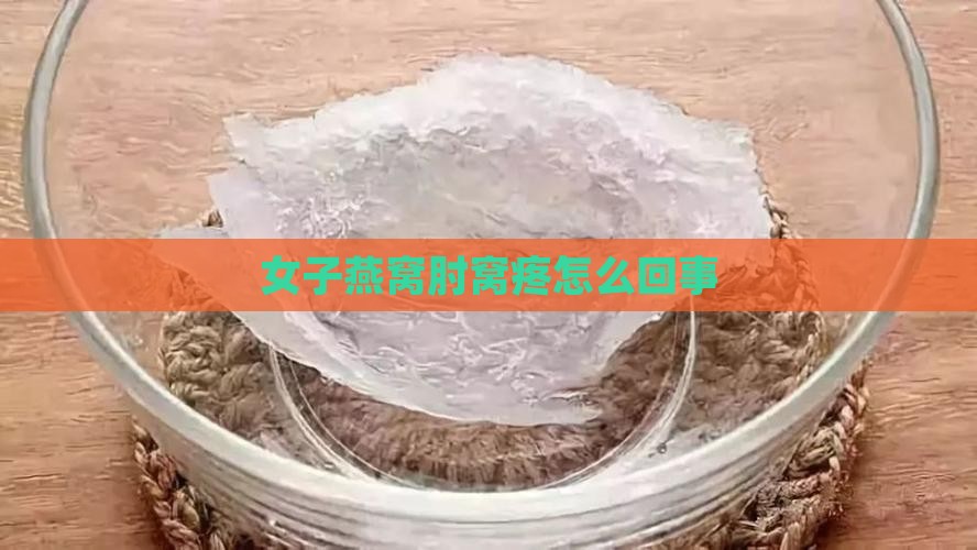 女子燕窝肘窝疼怎么回事